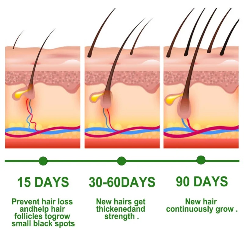 Сыворотка для роста волос, наб – обзор и цена Epidermal Growth Factor